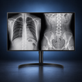 LG 32HL512D-B 31.5-inch 8MP diagnostic radiology monitor