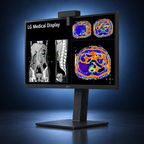 LG 27HS713C-B 8MP clinical review monitor angle view