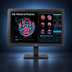 LG 24HR513C-B 24-inch 2MP diagnostic radiology monitor