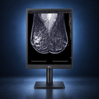 LG 21HQ613D-B 5MP mammography monitor front view