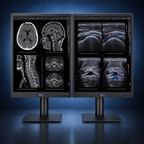 LG 21HQ613D-B diagnostic monitor displaying breast imaging studies
