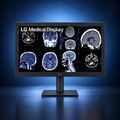 LG 32HQ713D-B 8MP diagnostic monitor displaying radiology images