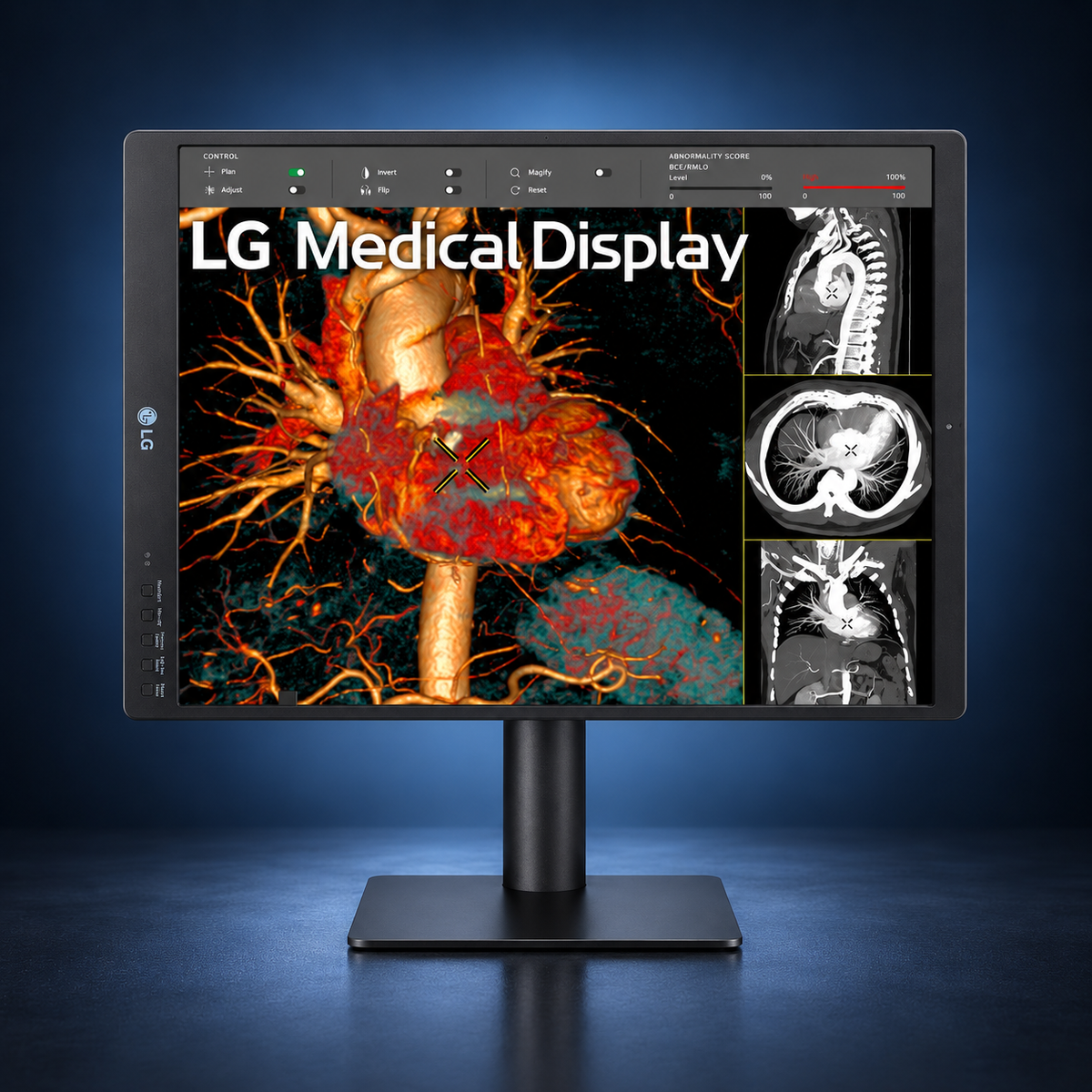 LG 21HQ513D-S 21.3-inch 3MP diagnostic radiology monitor