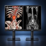 LG 21HQ513D-S 21.3-inch 3MP diagnostic radiology monitor