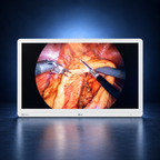 LG-32HR734S-W surgical monitor, front view, white housing against a dark blue studio background.