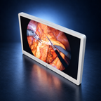 LG-32HR734S-W surgical monitor, high angle front view, white housing against a dark blue studio background.