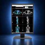 EIZO RadiForce RX370 monitor, front view in portrait orientation displaying medical images on a dark blue studio background.