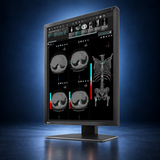 EIZO RadiForce MX217 monitor, angled front view showing medical images, the bezel, and full stand on a dark blue studio background.