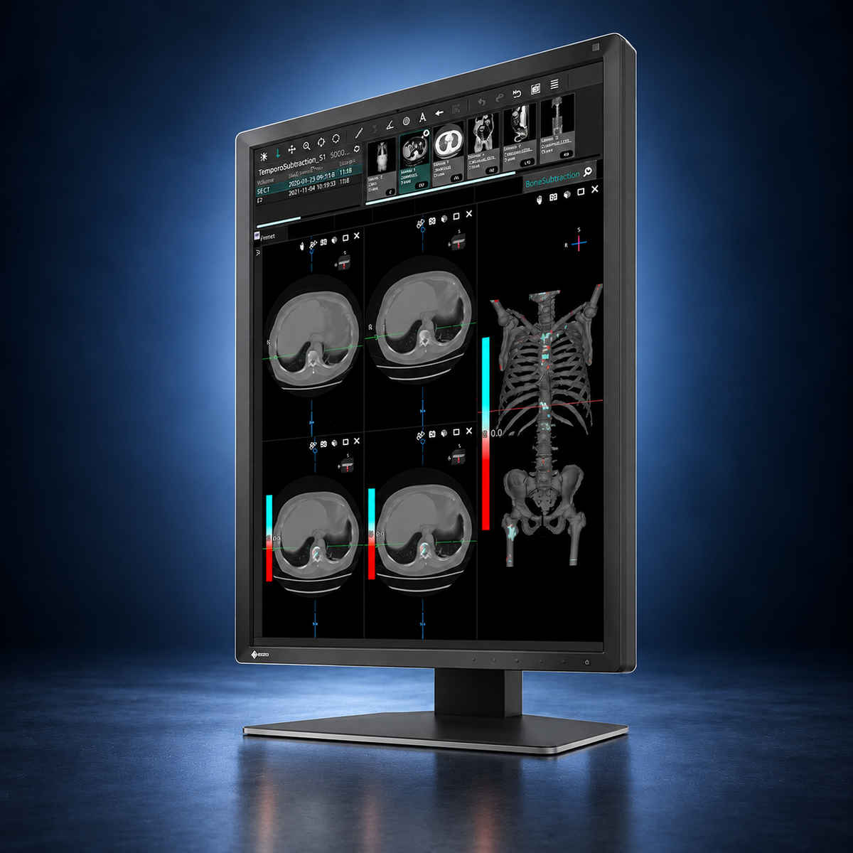 EIZO RadiForce MX217 monitor, angled front view showing medical images, the bezel, and full stand on a dark blue studio background.