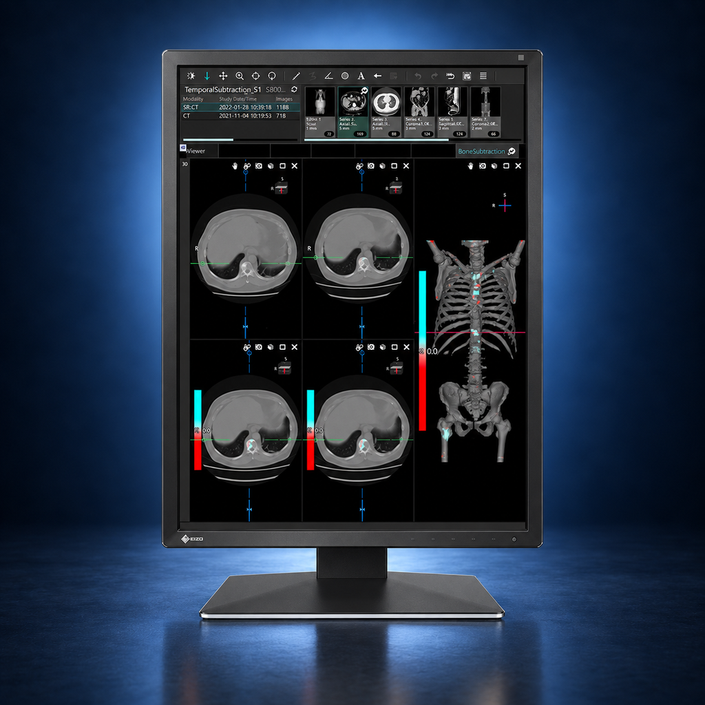 EIZO RadiForce MX217 monitor, front view in portrait orientation displaying medical images on a dark blue studio background.