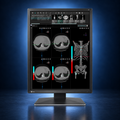 EIZO RadiForce MX217 monitor, front view in portrait orientation displaying medical images on a dark blue studio background.