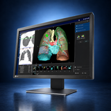 EIZO RadiForce MX243W monitor, angled front view showing medical images, the bezel, and full stand on a dark blue studio background.