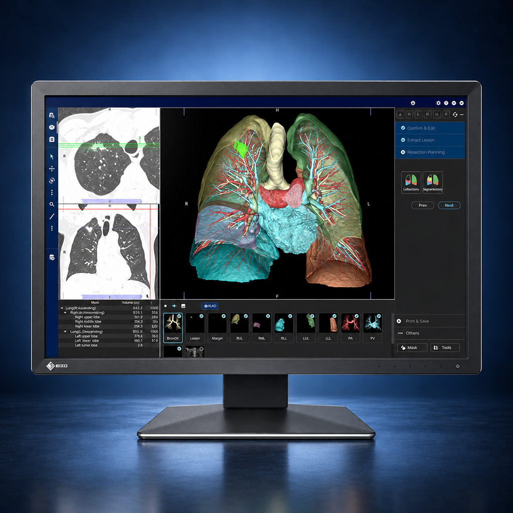 EIZO RadiForce MX243W monitor, front view in landscape orientation displaying medical images on a dark blue studio background.