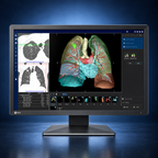 EIZO RadiForce MX243W monitor, front view in landscape orientation displaying medical images on a dark blue studio background.