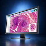EIZO RadiForce MX317W monitor, angled front view showing medical images, the bezel, and full stand on a dark blue studio background.