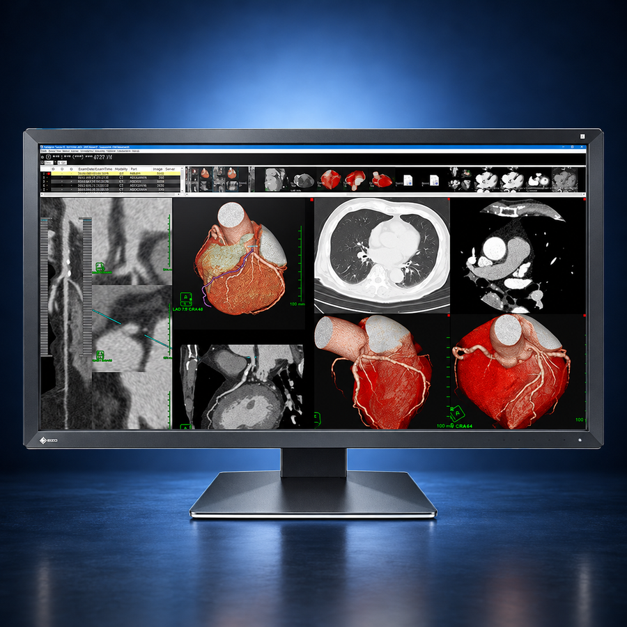 EIZO RadiForce MX317W monitor, front view in landscape orientation displaying medical images on a dark blue studio background.