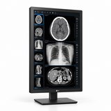 LG 24HR513C-B 24-inch medical display, portrait front view showing grayscale radiology images and its full stand on a white background.