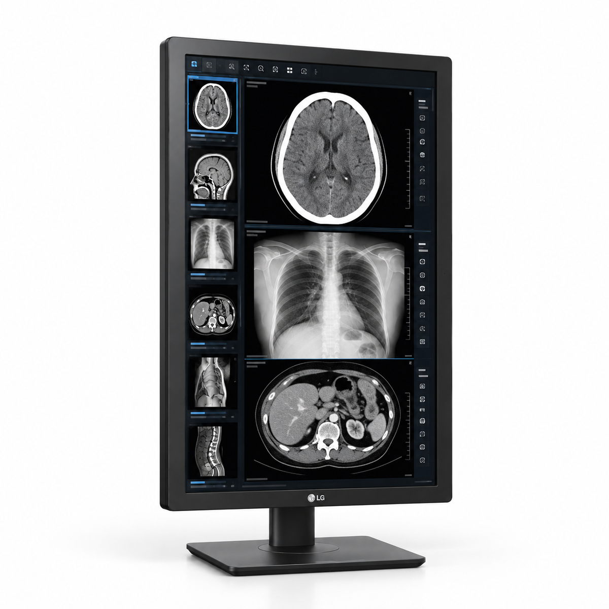 LG 24HR513C-B 24-inch medical display, portrait front view showing grayscale radiology images and its full stand on a white background.