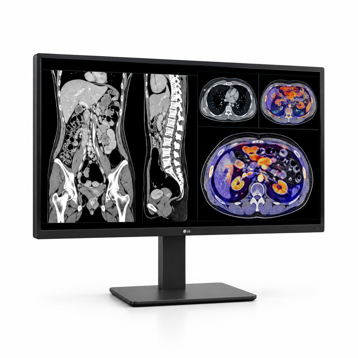 LG 27HS713C-B 27-inch clinical-review display, front view showing CT and color medical images and its full stand on a white background.