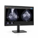 LG 31HN713D-B 31-inch mammography display, front view showing mammography comparison images and its full stand on a white background.