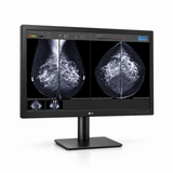 LG 31HN713D-B 31-inch mammography display, front view showing mammography comparison images and its full stand on a white background.