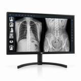 LG 32HL512D-B 31.5-inch medical display, landscape front view showing grayscale radiology images and its full stand on a white background.