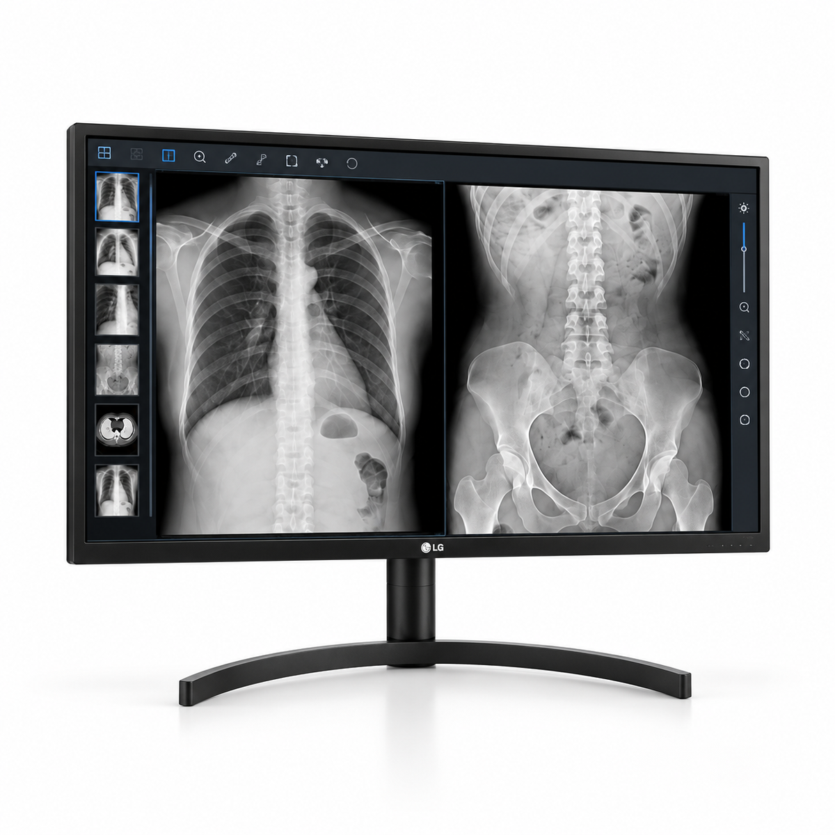 LG 32HL512D-B 31.5-inch medical display, landscape front view showing grayscale radiology images and its full stand on a white background.