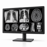 LG 32HQ713D-B 31.5-inch diagnostic radiology display, front view showing grayscale medical images and its full stand on a white background.