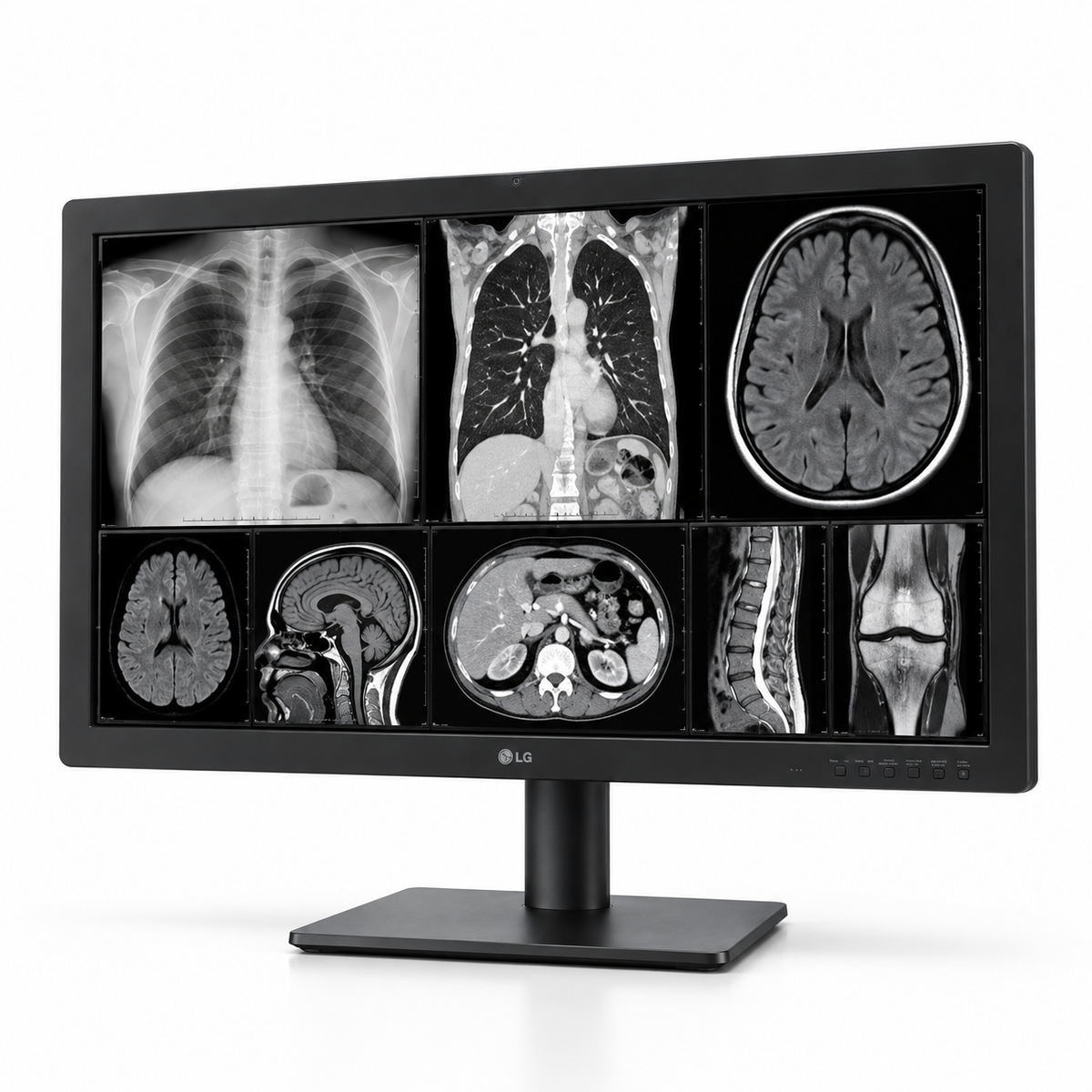 LG 32HQ713D-B 31.5-inch diagnostic radiology display, front view showing grayscale medical images and its full stand on a white background.