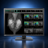 EIZO RadiForce RX1270 monitor, front view in landscape orientation displaying medical images on a dark blue studio background.