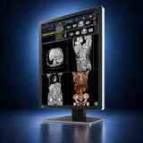 EIZO RadiForce RX270 monitor, angled front view showing medical images, the bezel, and full stand on a dark blue studio background.