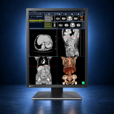 EIZO RadiForce RX270 monitor, front view in portrait orientation displaying medical images on a dark blue studio background.