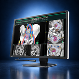 EIZO RadiForce RX670 monitor, angled front view showing medical images, the bezel, and full stand on a dark blue studio background.
