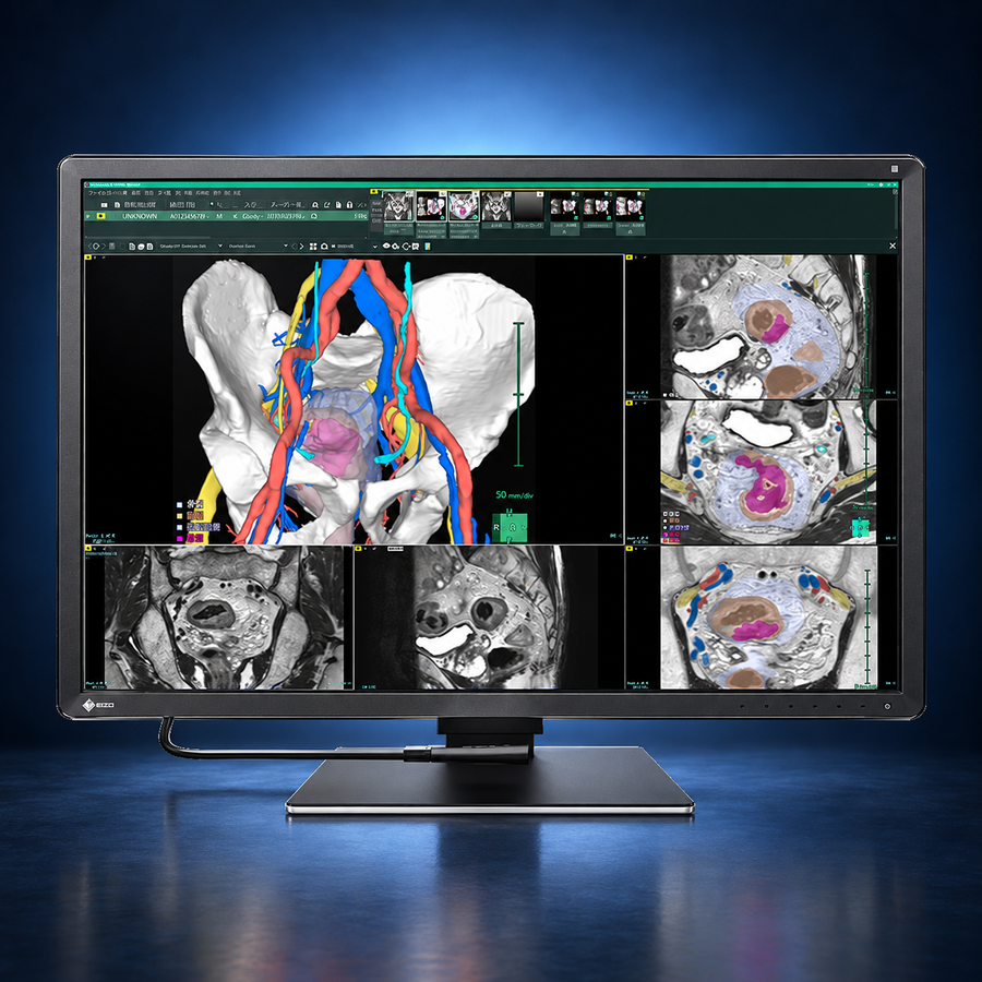 EIZO RadiForce RX670 monitor, front view in landscape orientation displaying medical images on a dark blue studio background.