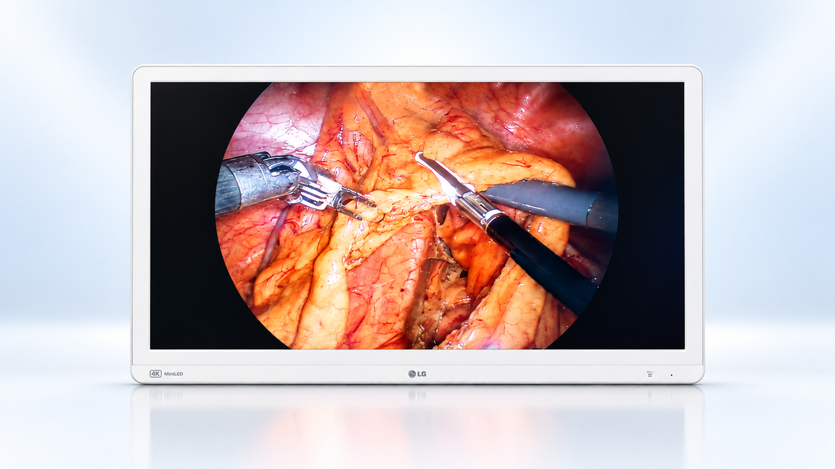 LG 32HR734S-W white surgical monitor displaying an illustrative surgical video image on a pale blue studio background